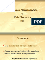 Neumonía Neumococcica