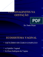 Vulvovaginites Na GestaÇÃo