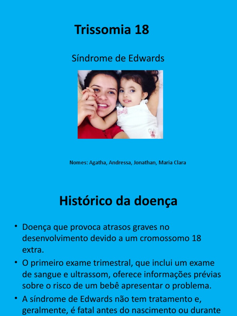 Trissomia 18 | PDF