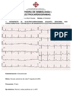 Tarea Ekg