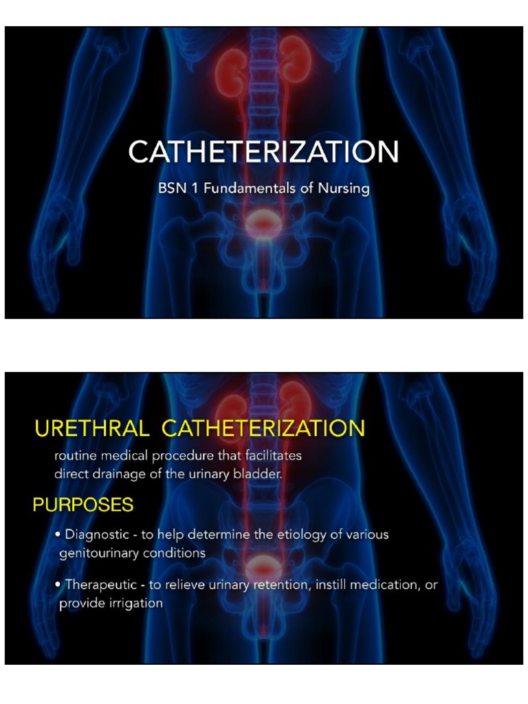 Catheterization PDF