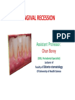 14 - Gingival Recession