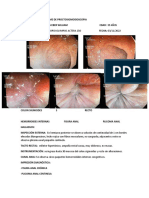 Informe de Proctosigmoidoscopia Tafur