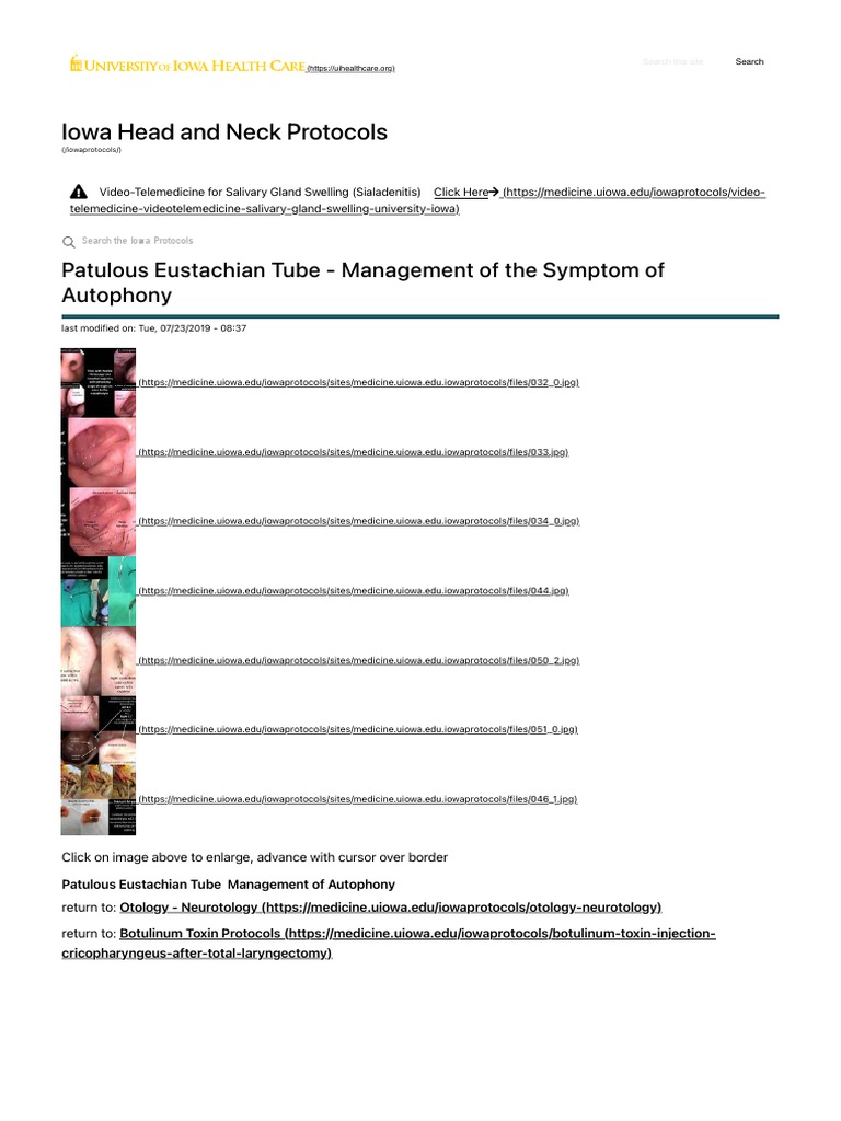 Patulous Eustachian Tube Management of The Symptom of Autophony
