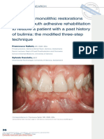 4.CADCAMmonolithicrestorationsandfull-mouthadhesiverehabilitationtorestoreapatientwithapasthistoryofbulimiathemodiedthree-steptechnique-FrancescaVailati