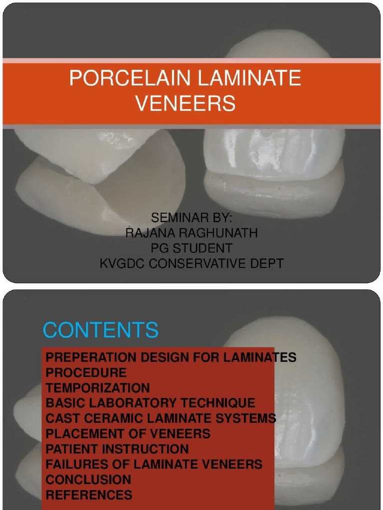 Porcelain Laminate Veneer | PDF - Marble To Porcelain Veneer Conversion