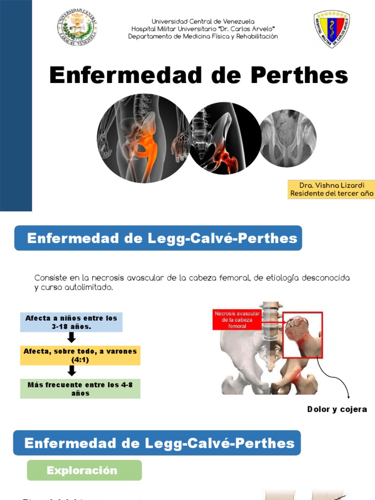 Enfermedad de Pethers VISHNA | PDF | Rodilla | Medicina CLINICA