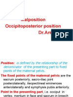 Malposition Occiput