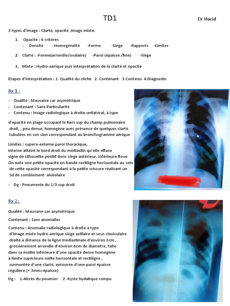 DR Hacid | PDF | Poumon | Spécialités médicales