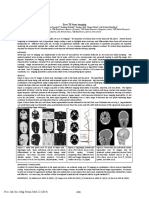 Zero TE Bone Imaging ISMRM 2014 4261