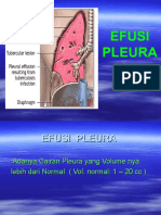 Dokumen_tips_efusi_pleura_power_point