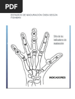 Radiografía de Mano y Edad Ósea | PDF | Mano | Hueso