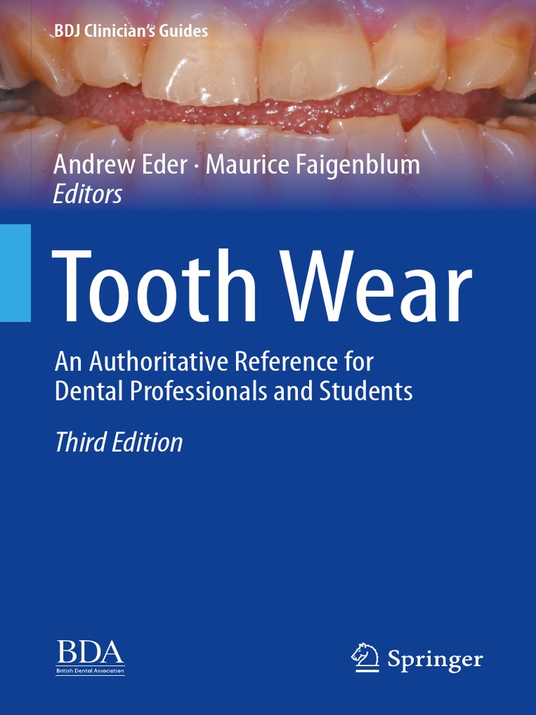 Tooth Wear PDF