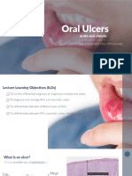 Oral Ulcers: Acute and Chronic