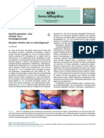 Carta Científico-Clínica: Queilitis Glandular. ¿Una Entidad Rara o Infradiagnosticada?