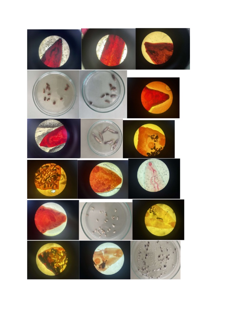 gambar trematoda | PDF
