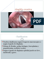 Laringitis Cronica