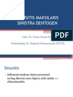 sinusitis-maksilaris-dentogen-sinistra