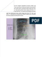 PDF Kerley Line - Compress