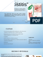 Colecistitis