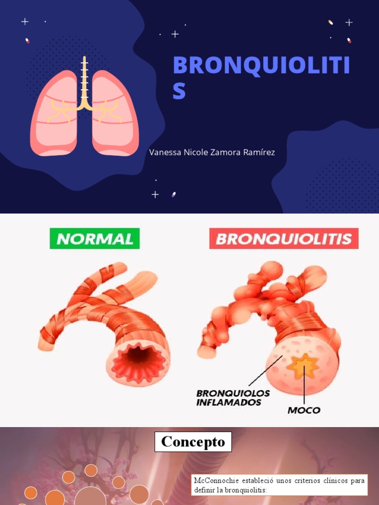 Bronquiolitis APS | PDF | Medicina | Enfermedades y trastornos