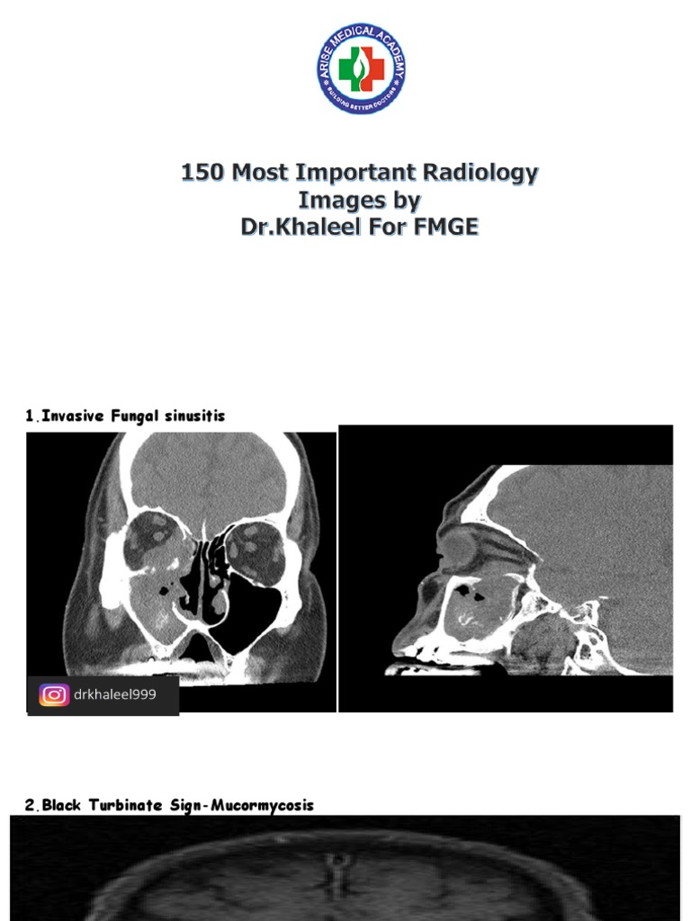 150 Most Important Radiology Images by DR Khaleel PDF