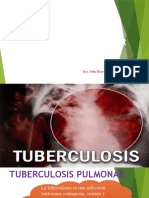 Tuberculosis