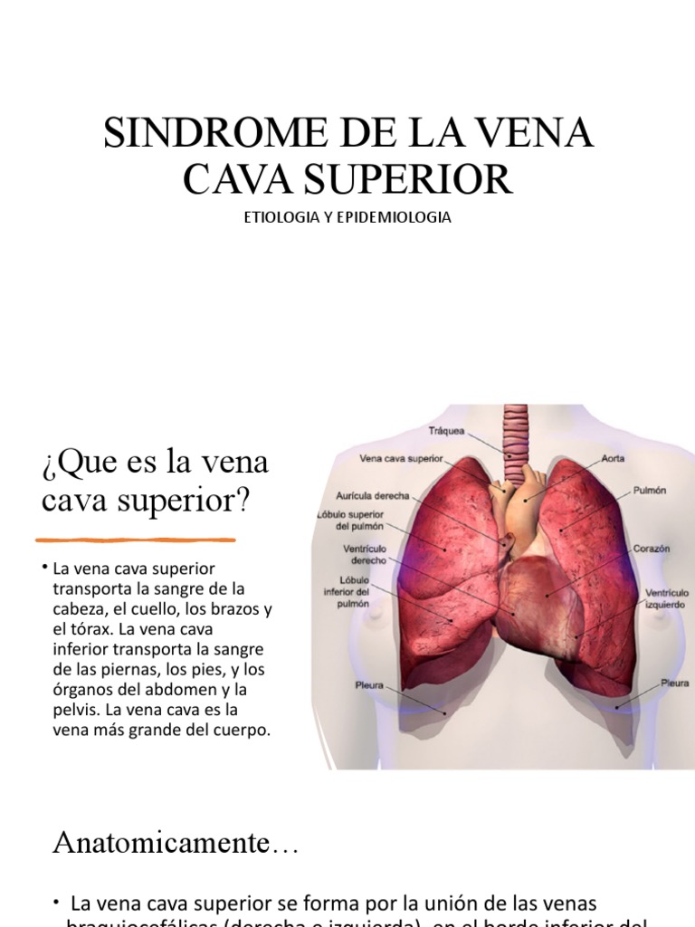 sindrome-de-la-vena-cava-superior-pdf-vena-c-ncer
