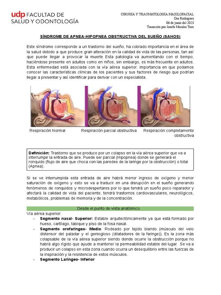 SAHOS: Diagnóstico y Tratamiento | PDF