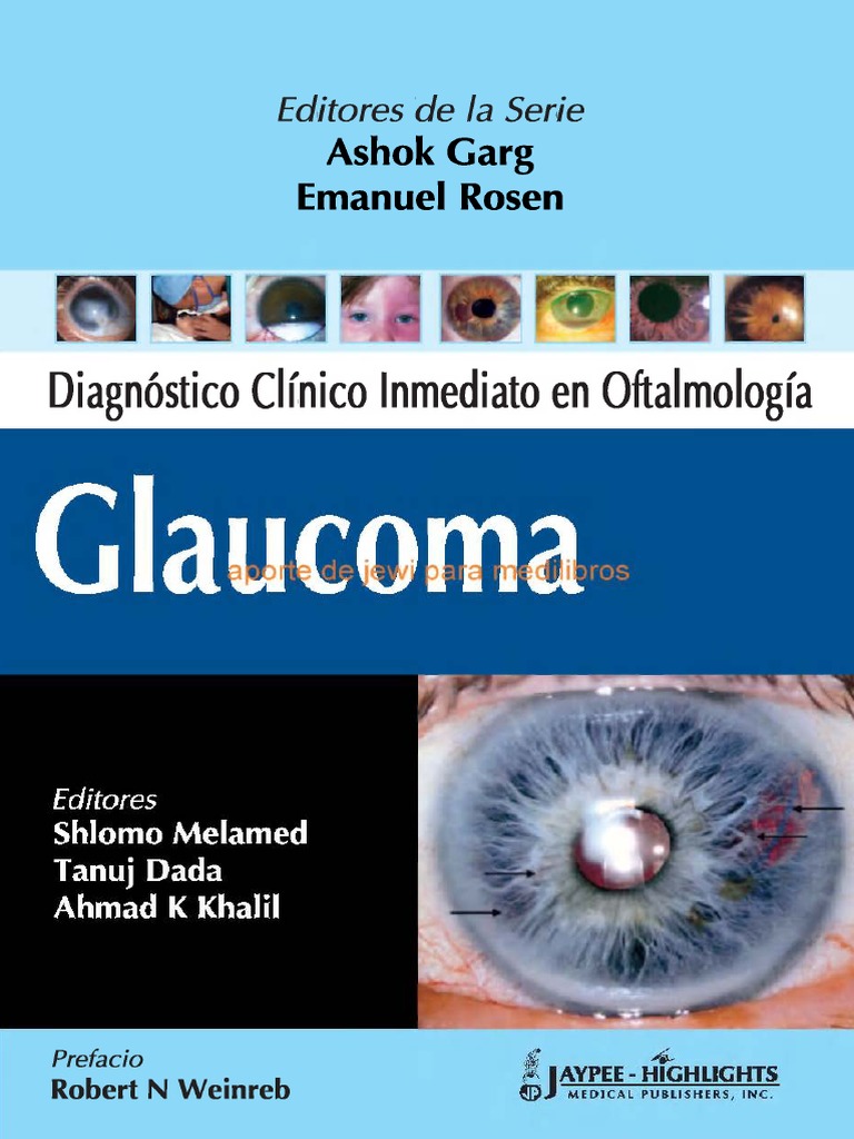 Varios - Diagnostico Clinico Inmediato en Oftalmologia | PDF