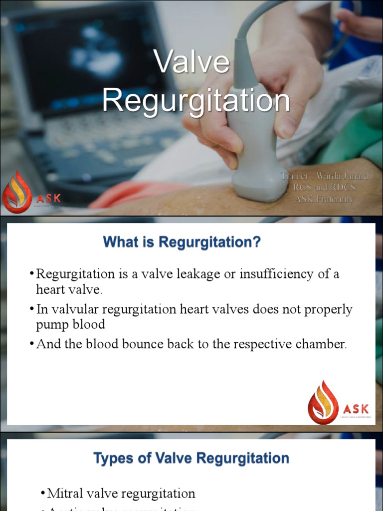 Valve Regurgitation PDF