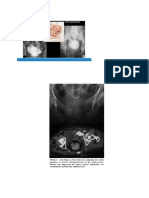 Trauma Vesical