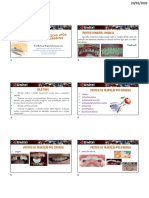 Revisão Prótese X Cirurgia PDF