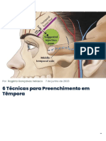 6 Técnicas para Preenchimento em Têmpora Instituto Velasco