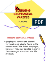 5c.BLEEDING ESOPHAGEAL VARICES
