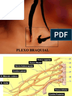 Plexo Braquial Modificado