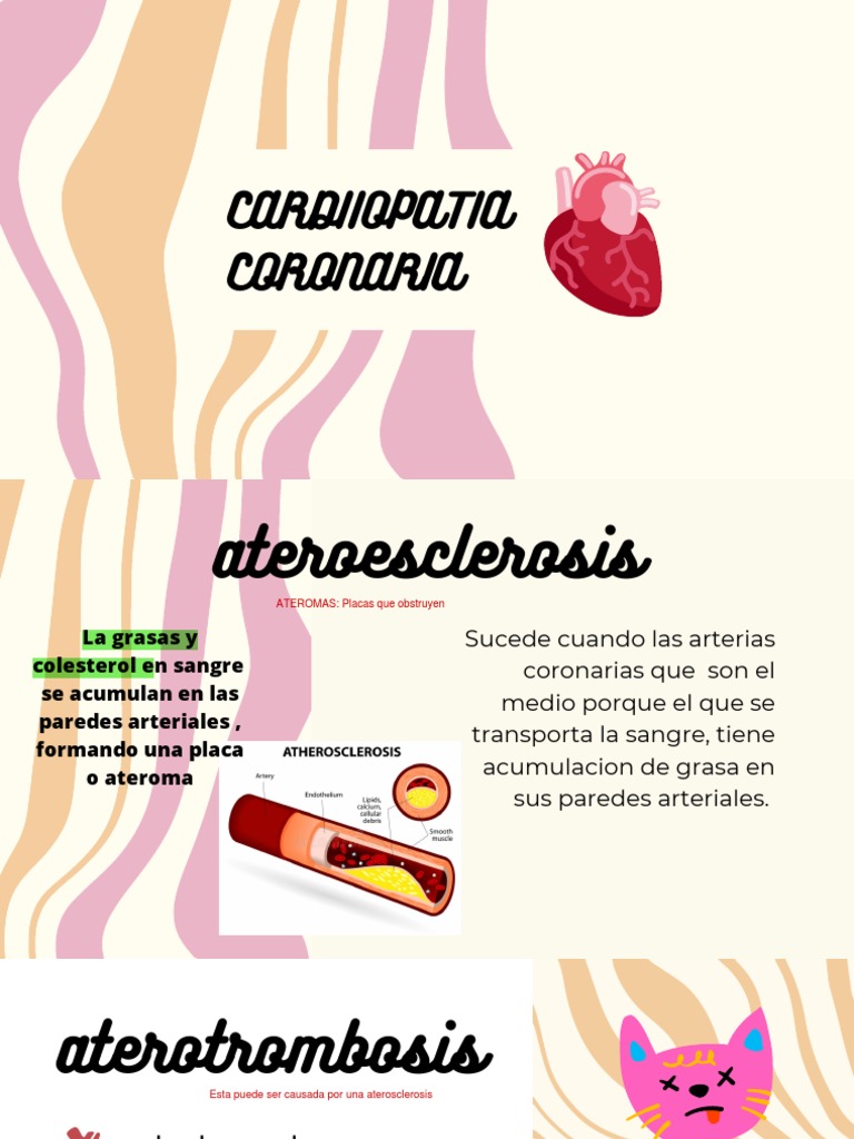 Cardiiopatia Coronaria | PDF | Infarto de miocardio | Corazón