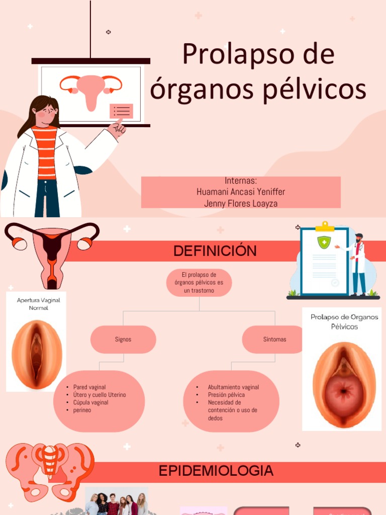 Prolapso de Órganos Pélvicos: Guía Completa | PDF | Parto | Pelvis