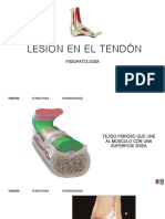 Lesión en El Tendón