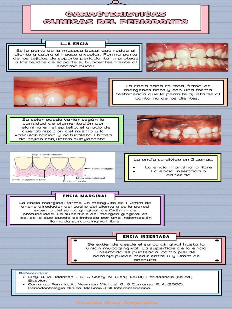 Características de la encía saludable | PDF