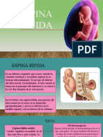 Espina Bifida2