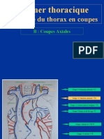 TDM Thoracique