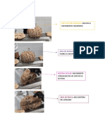 Anatomia-Areas Del Cerebro