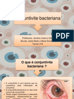 Conjuntivite