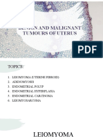 Benign and Malignant Tumor of Uterus