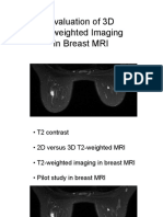 Evaluation of 3D T2-Weighted Imaging in Breast MRI