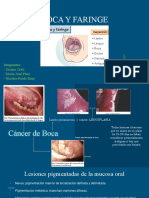 Cáncer de Boca, Pelsiones Pigmentarias de Mucosa Oral y Faringe