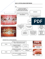 Unidad 10: Patologias Dentarias: Hipoplasia