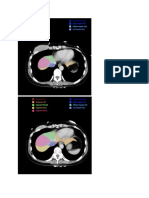 CT Liver Anatomy