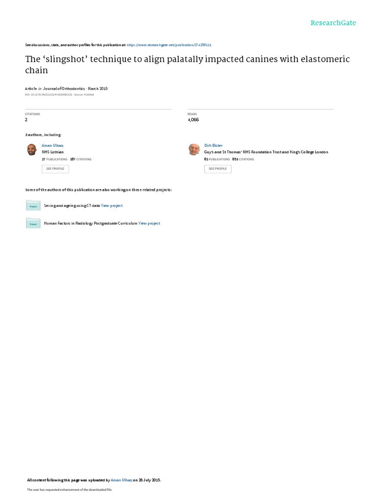 The Slingshot' Technique To Align Palatally Impacted Canines With